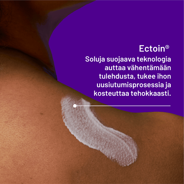 Locobase Psoriasis Cream kosteuttaa ja rauhoittaa psoriasiksen ärtynyttä ihoa