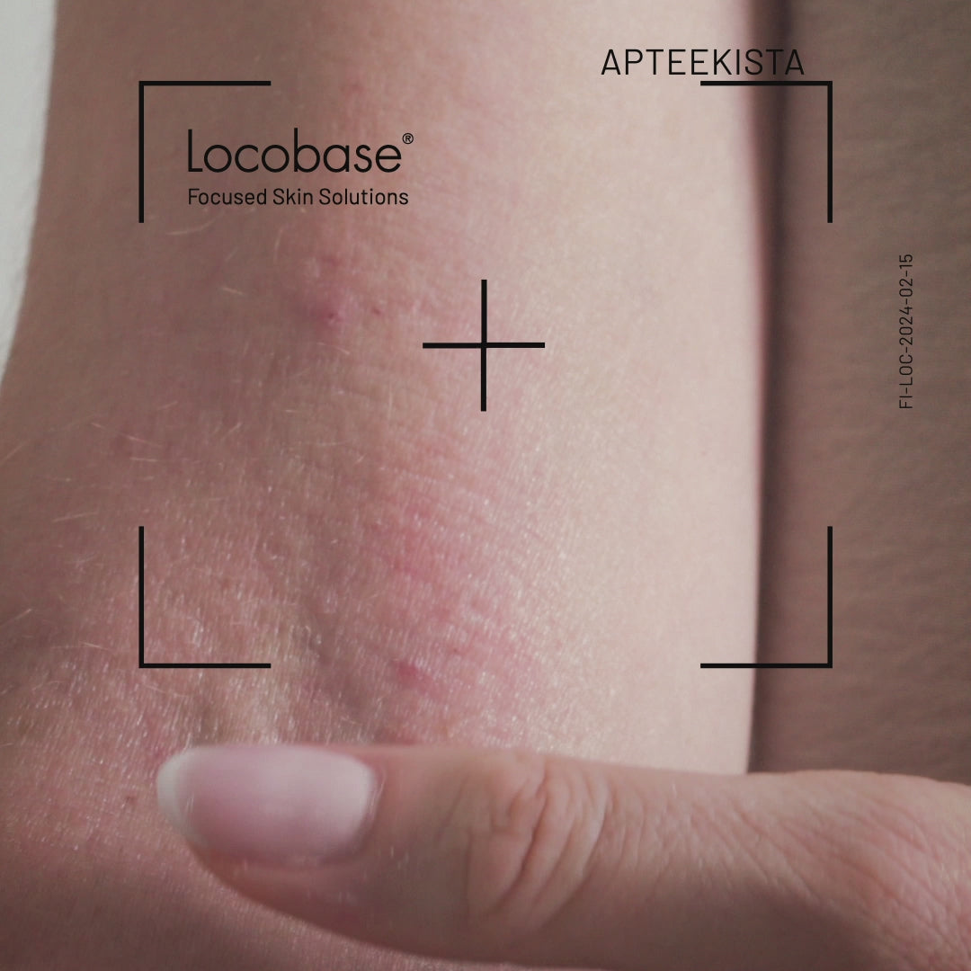 Locobase Eczema Cream - Atooppiselle iholle